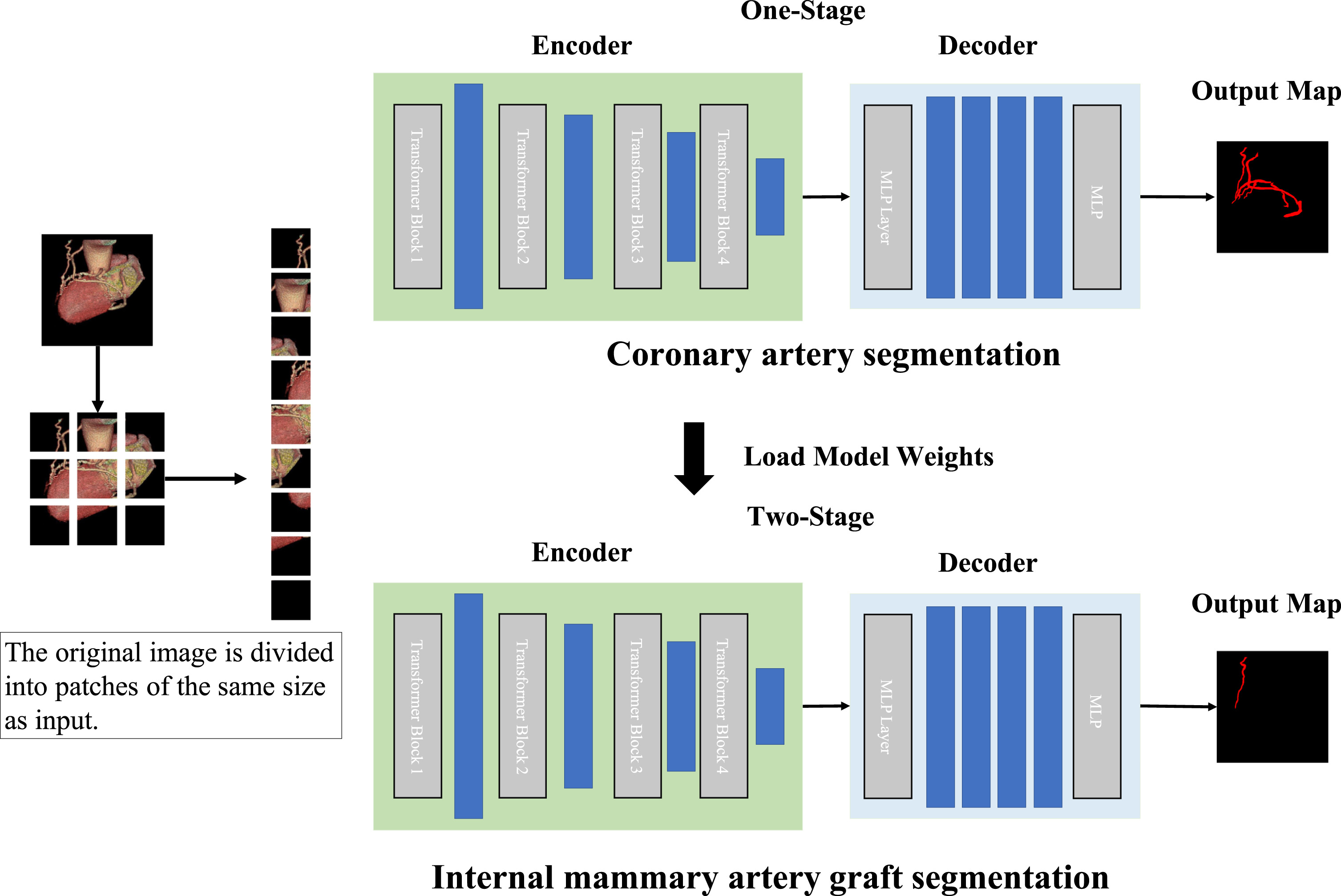 Two-stage training strategy combined with neural network for segmentation of internal mammary artery graft
